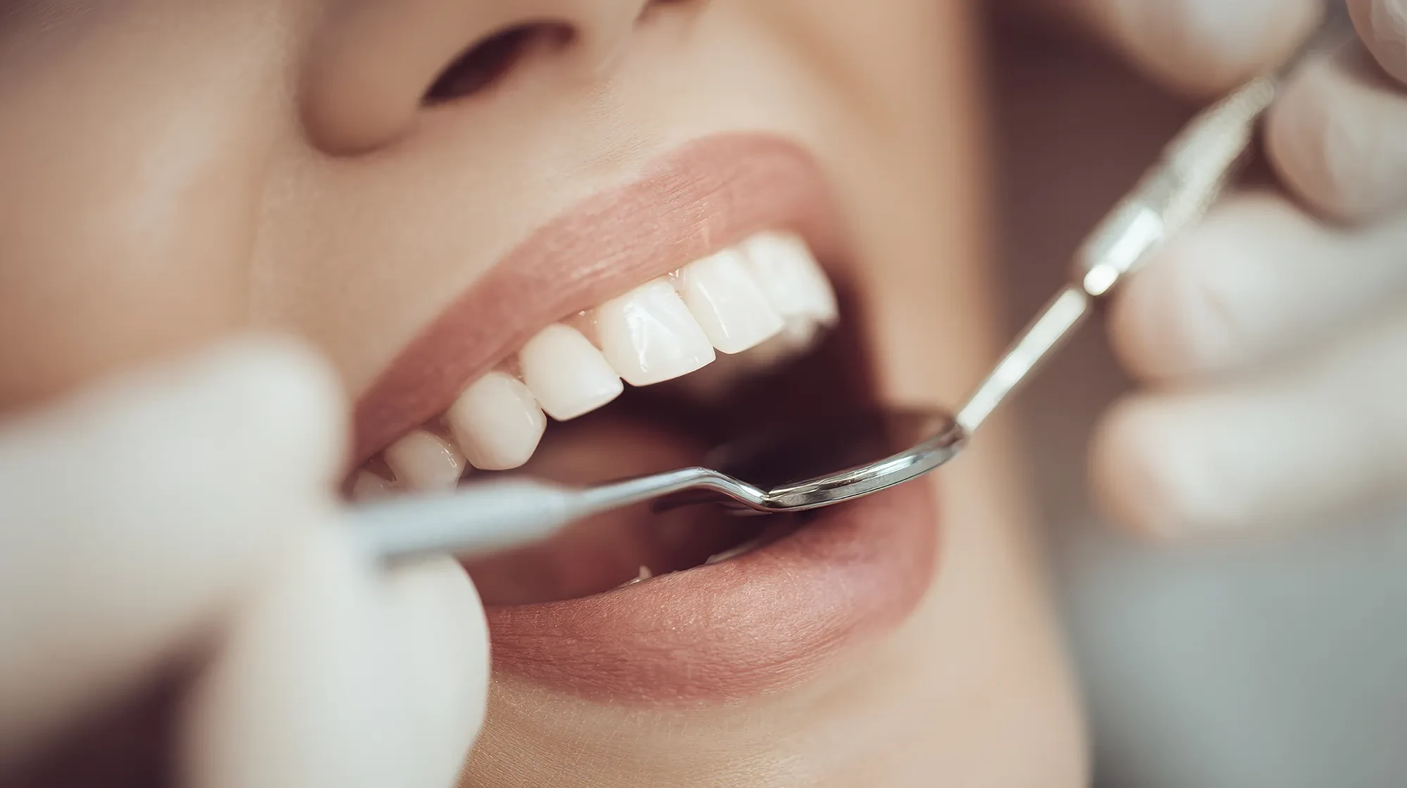 Nahaufnahme einer zahnärztlichen Untersuchung, gesunde Zähne und Dentalspiegel