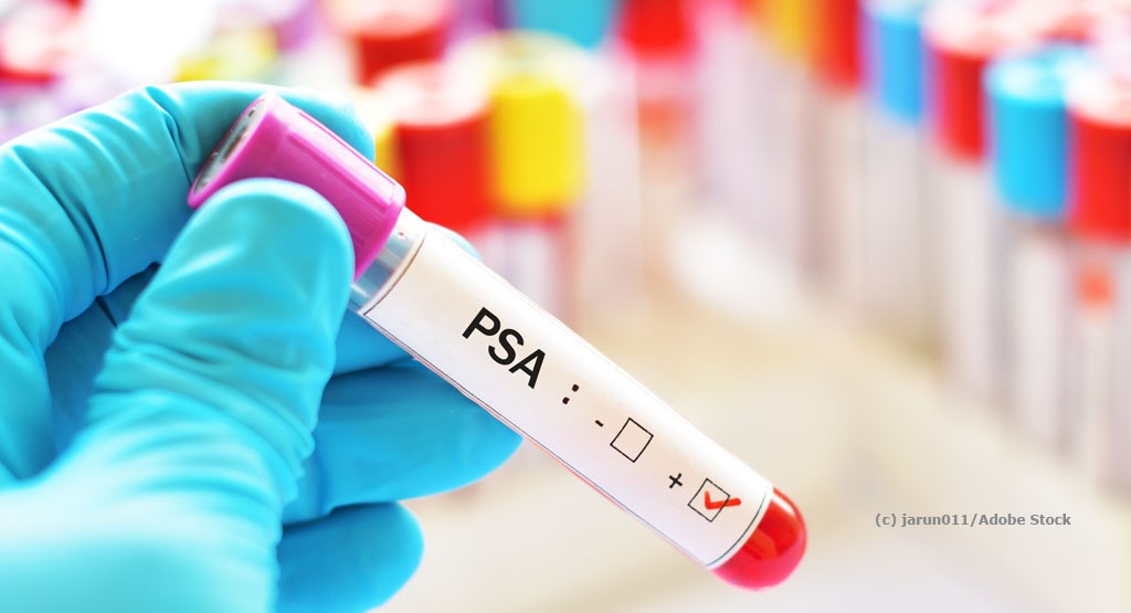 Prostata Hilfe Deutschland: Risikoadaptierter PSA-Test