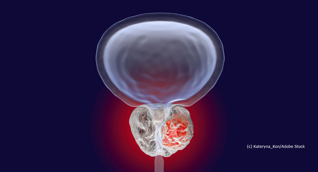 Prostata Hilfe Deutschland: Illustrationsbild Prostata