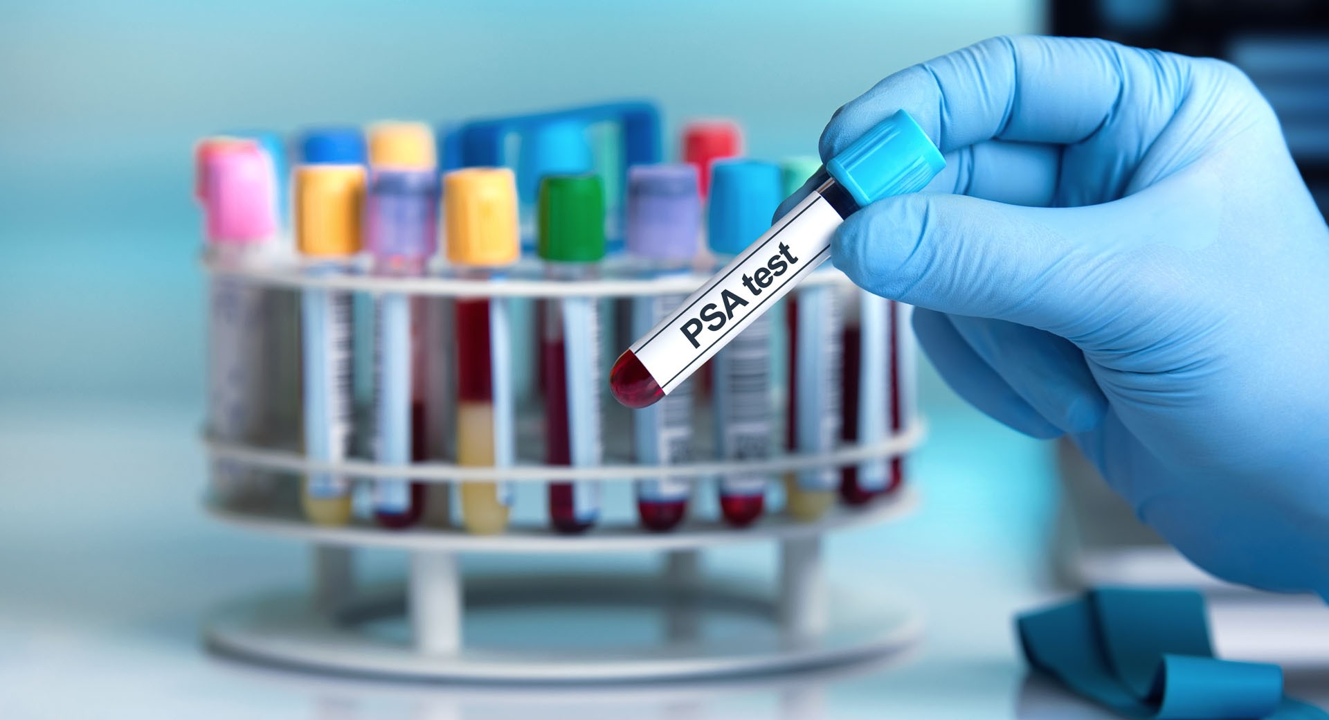Prostata Hilfe Deutschland: Labor mit Röhrchen und Aufschrift PSA-Test