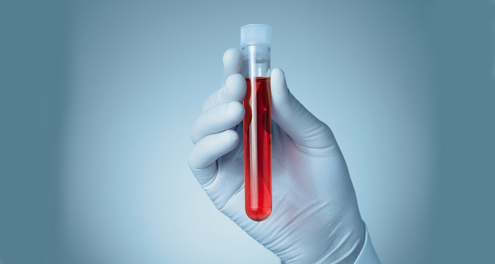 Prostata Hilfe Deutschland: Hand mit weißen Handschuhen hält Röhrchen mit Blut