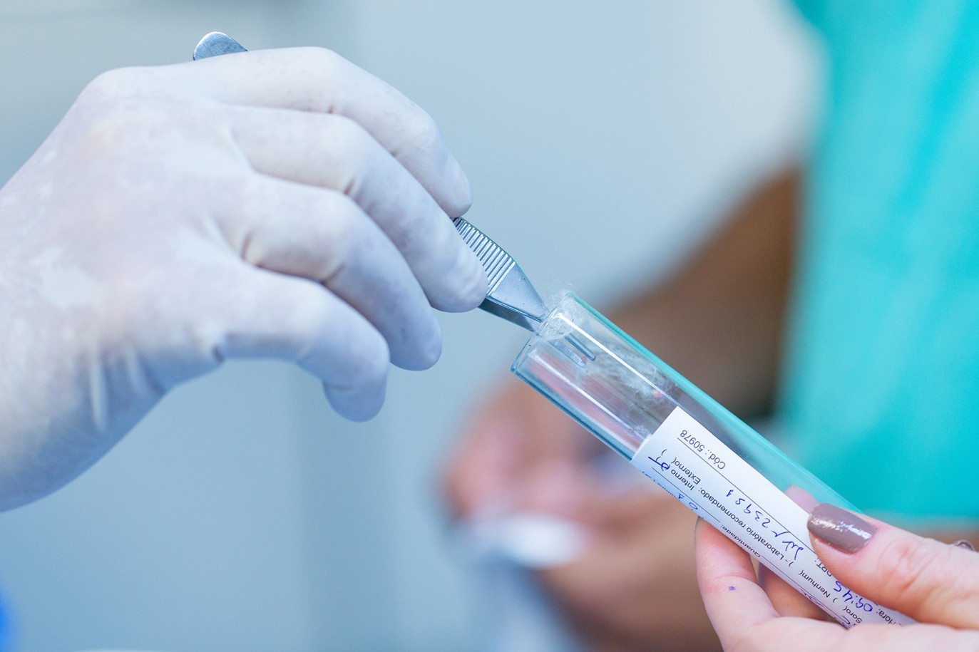 Ist eine Prostatabiopsie wirklich nötig? Prostata Hilfe Deutschland: Reagenzglas und Pinzette