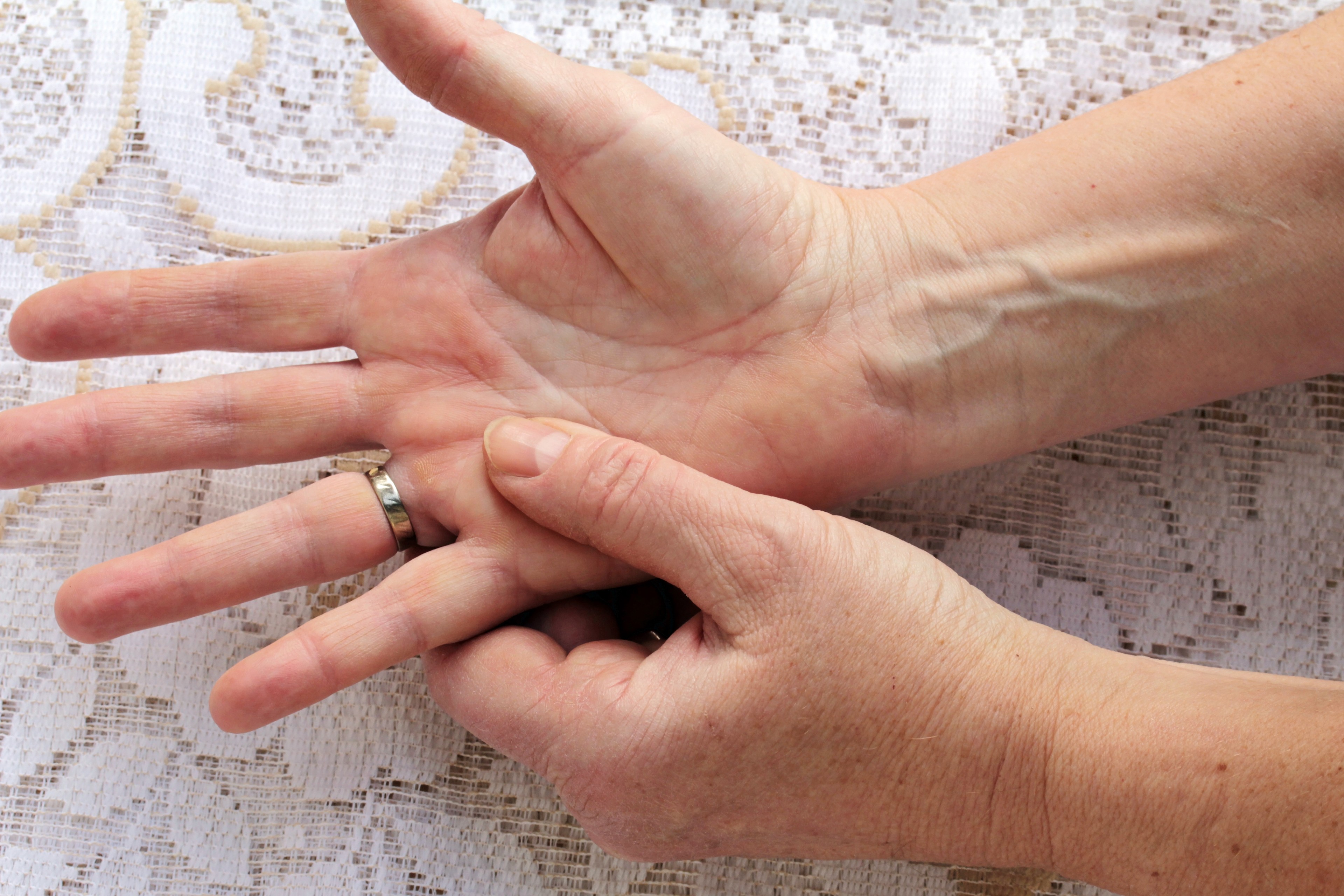 Wie lassen sich trockene und rissige Hände richtig und wirksam pflegen?