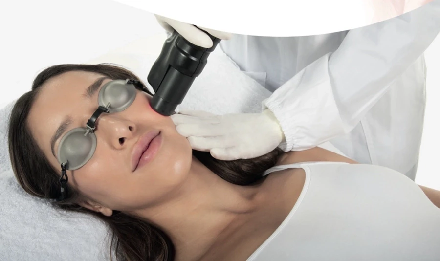 Kollagenlaser Behandlung am Hals einer Frau im Kosmetikstudio