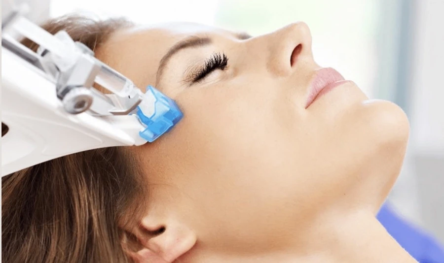 Vakuum Needling Behandlung am Hals zur Hautstraffung und Regeneration