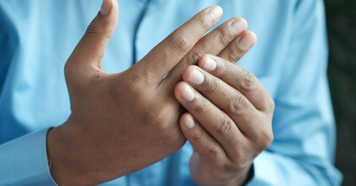 Hand-Symptome: Nahaufnahme einer Hand mit möglichen Anzeichen von Beschwerden oder Schmerzen