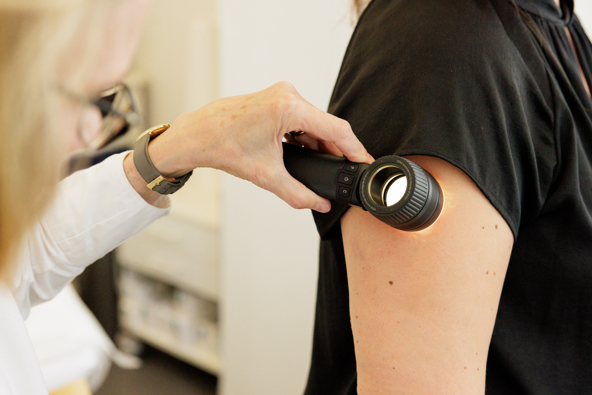 Hautuntersuchung in einer Arztpraxis mit einem Dermatoskop am Oberarm eines Patienten