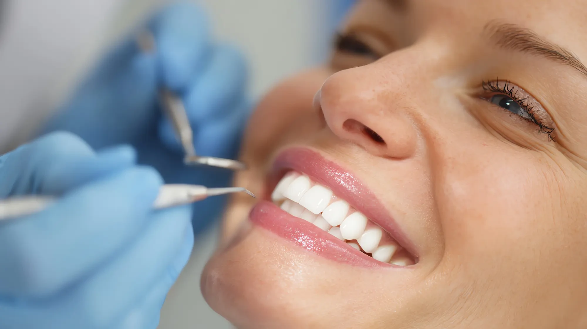 Frau mit Zahnersatz bei zahnärztlicher Behandlung – Nahaufnahme eines Lächelns mit schönen Zähnen