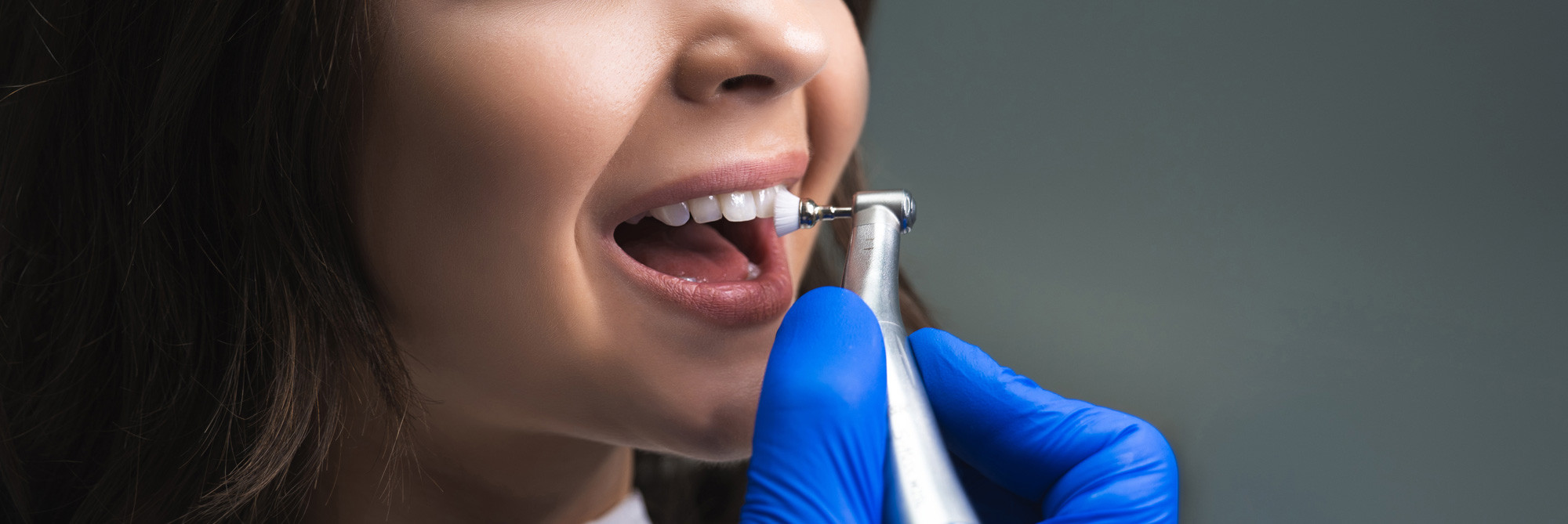 Gemeinschaftspraxis Zahnärzte in Braunschweig, process of using dental brush as a stage of professional dental cleaning