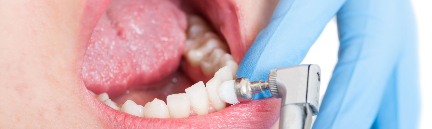 Prophylaxe | Zahnarztpraxis Dr. Anne Hoting in Weyhe
