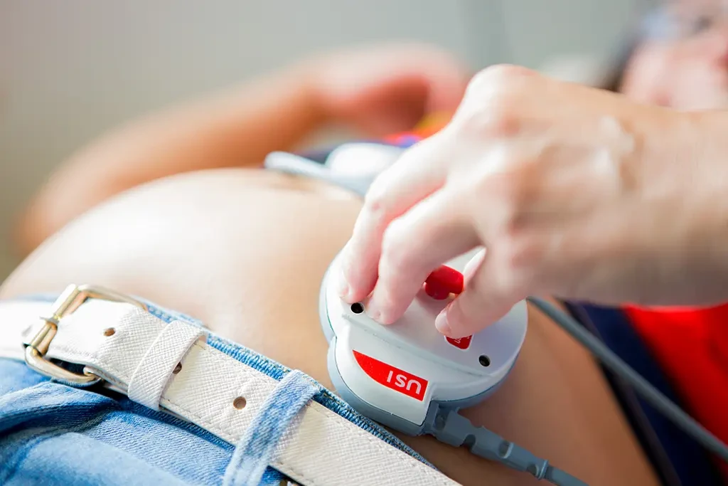 CTG-Untersuchung in der 25. Schwangerschaftswoche (SSW) zur Überwachung der Herztöne des Babys