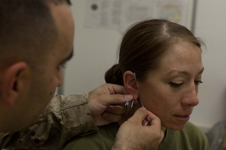 Militärarzt wendet Akupunktur an einer Patientin an