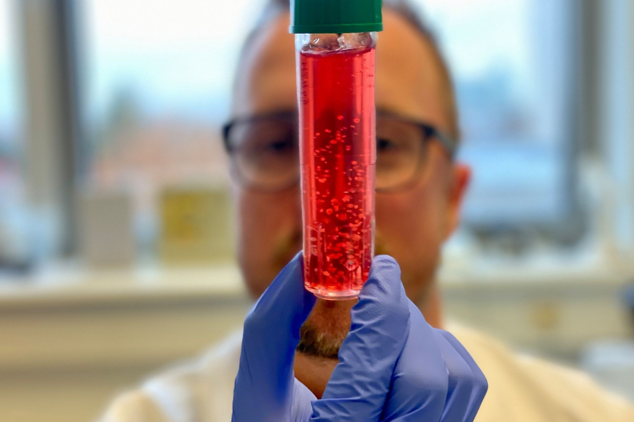 Person mit blauen Handschuhen hält ein Reagenzglas – lachmann-2