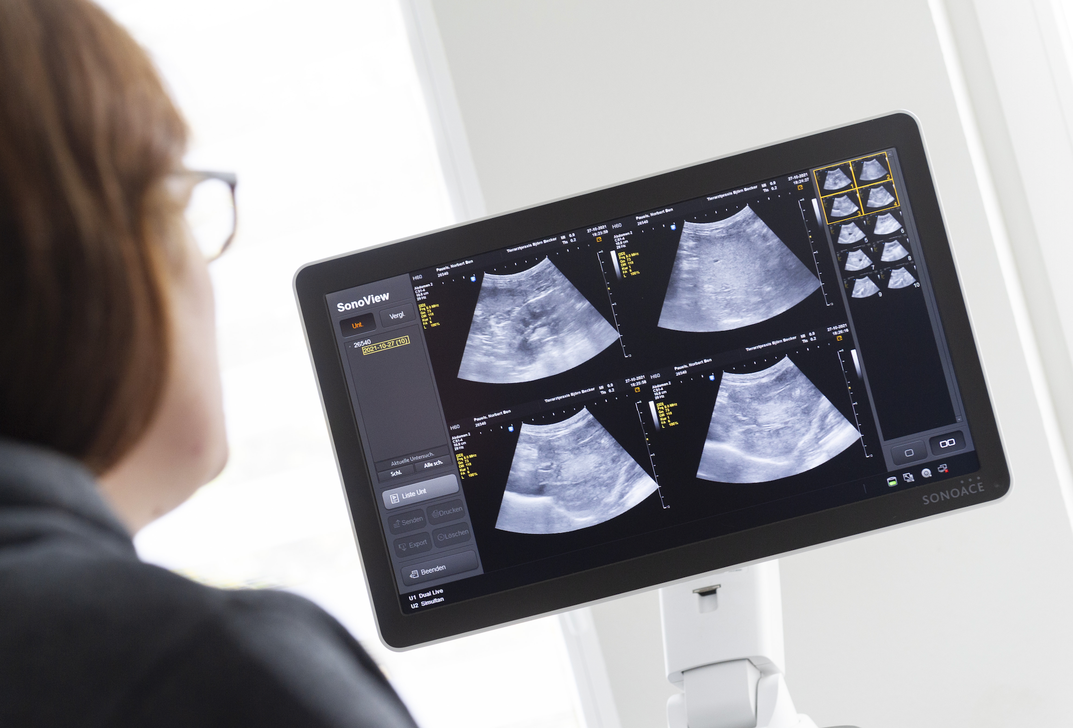 Ultraschalluntersuchung in Gildehaus auf einem SonoView-Gerät